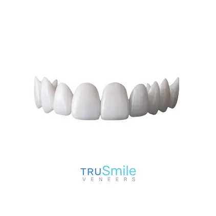 TruSmile snap-on veneers example